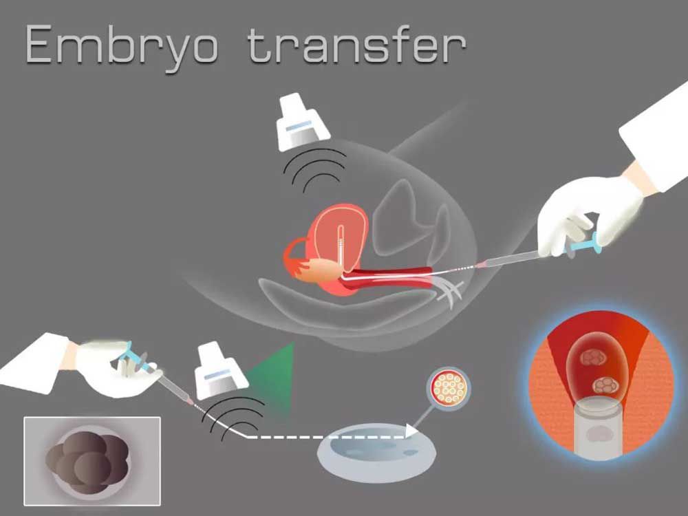 双侧输卵管切除还能怀孕做试管婴儿吗？
