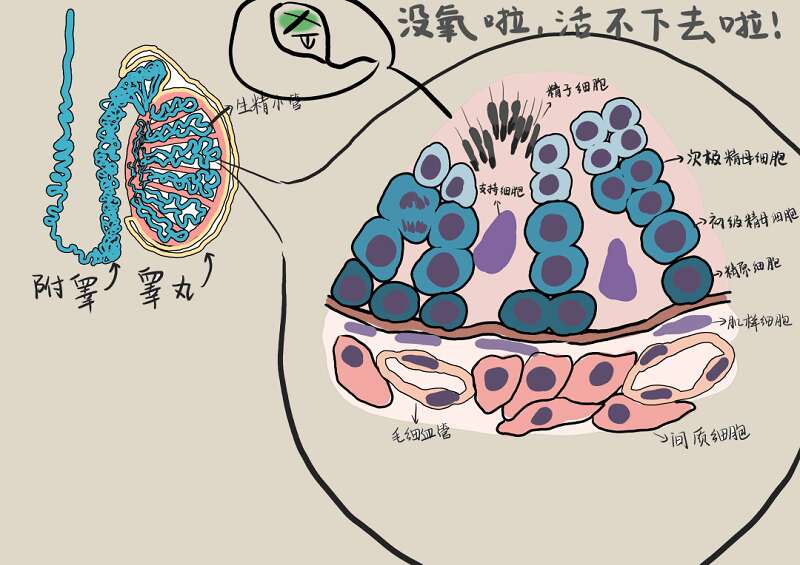 试管检查前发现精子质量低？可能是精索静脉曲