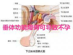 垂体功能障碍可导致不孕