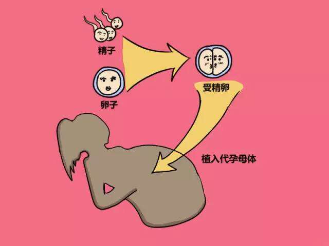 漫画解读什么是广州助孕